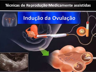 1ª Ecografia de Monitorização :)