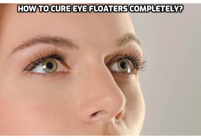 Surgery is the only type of medical eye floaters treatment currently available. The most common type of surgery for eye floaters removal is vitrectomy, which involves removing the vitreous humor (the gel-like solution in the eye) together with any debris (the 'floaters') and replacing it with a saltwater solution. The other type of surgery for eye floaters treatment is YAG laser removal. This procedure uses a specialized laser to burn off the individual floaters.