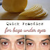 Quick remedies for bags under eyes