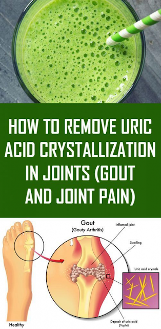 How to Quickly Remove Uric Acid Crystallization From Your Body to Prevent Gout and Joint Pain