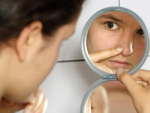 Bagaimana cara menghilangkan komedo di hidung atau di wajah secara alami dengan cepat tanpa efek samping untuk kecantikan muka