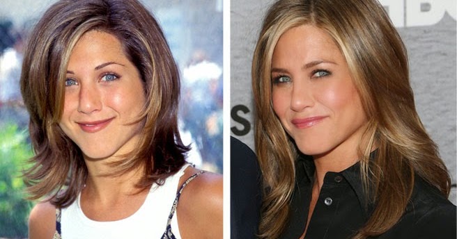 Jennifer Aniston Plastic Surgery Eyelid, Facelift Before ...