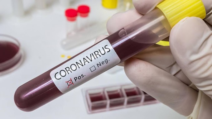 COVID-19 CORONAVIRUS: FALSA PANDEMIA?