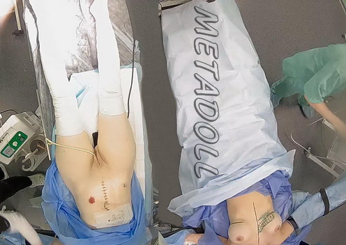 Hospital Secretly Filmed Women During Surgery (Women during operation 14)