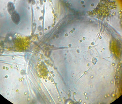 Chlorophyll in the Plant  Cells