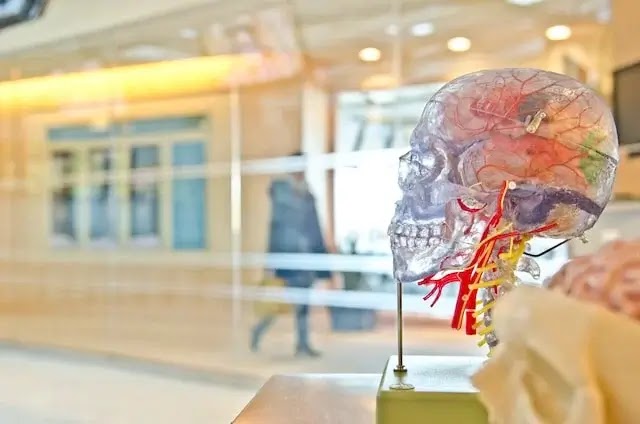 ما هو تمدد الأوعية الدموية في الدماغ؟