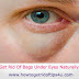 Get Rid Of Bags Under Eyes Naturally At Home