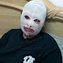 Mangsa simbahan asid hilang penglihatan.