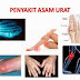 Membuat Ramuat Obat Alami Asam Urat Sendiri | gakbosan.blogspot.com | gakbosan.blogspot.com