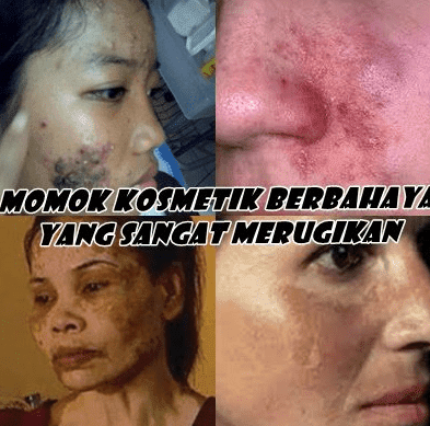 Perbedaan tje fuk asli palsu yang benar