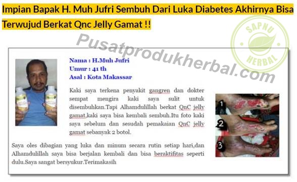 Cara Mengobati Kurap Kering Yang Melebar Dengan Cepat , TERBUKTI Ampuh!!