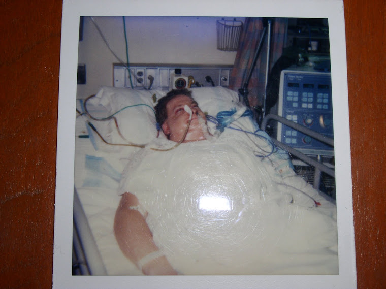 Polaroid on 8/17/1992 in intensive care after reconstructive jaw surgery.