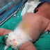  Χιλή: Γεννήθηκε το βαρύτερο μωρό στον κόσμο και ζυγίζει λίγο παραπάνω από 7 κιλά 