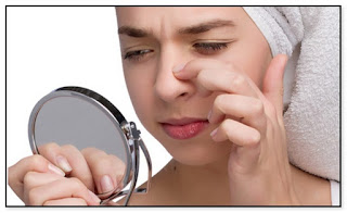 What factors causes Acne
