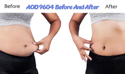 AOD 9604 Before And After