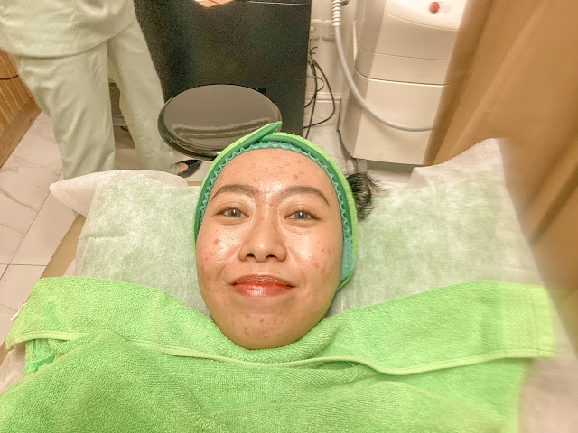 photo-facial-acne-di-zap-untuk-treatment-jerawat