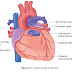 Pathology: Cardiac Pathology: