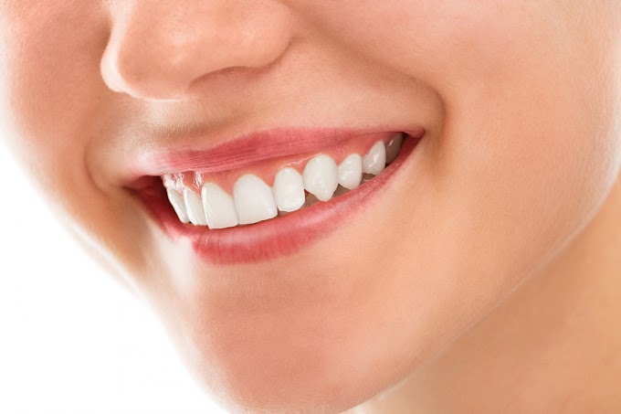 5 Penyebab Sakit Gigi Berkepanjangan - Distributor Skincare Lumajang