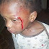 Photos; 2 year old girl was allegedly beaten by her mother for not being able to count 1 - 200