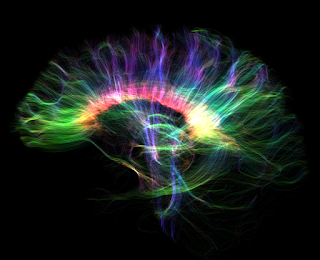 A scan from the MAGNUS MRI scanner. The image outlines a brain with rainbow colors.