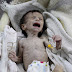 Frail face of Syria's agony: Starving baby who weighs just 4lbs wails in pain as he clings to life (8 Pics)