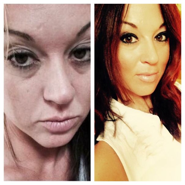 10+ Before-And-After Pics Show What Happens When You Stop Drinking - 15 Months Sober
