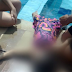 Criança de 6 anos se afoga após cair em piscina de condomínio em Manaus; ela foi reanimada