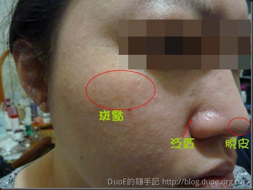 花臉