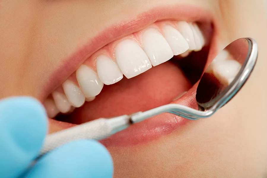 Formas naturais para restaurar a saúde natural da boca e prevenir a carie 
