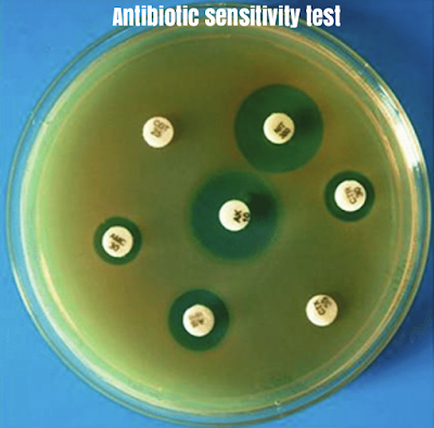 antibiotic sensitivity test