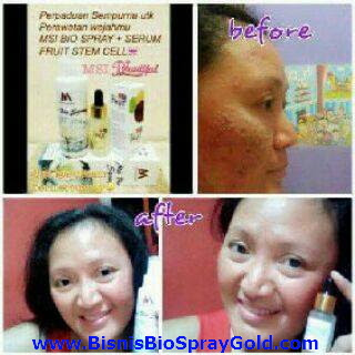 Testimoni MSI Bio Spray, Testimoni MSI Multy Spray