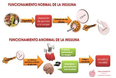 Resistencia a la Insulina Causas