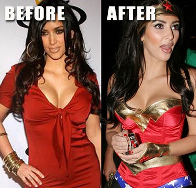 kim kardashian plastic surgery before after. Kim Kardashian is one of the