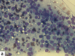 População de células linfóides