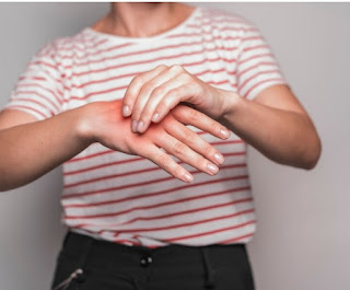 Imagen de sección media de mujer con inflamación en las manos, signo de Artritis