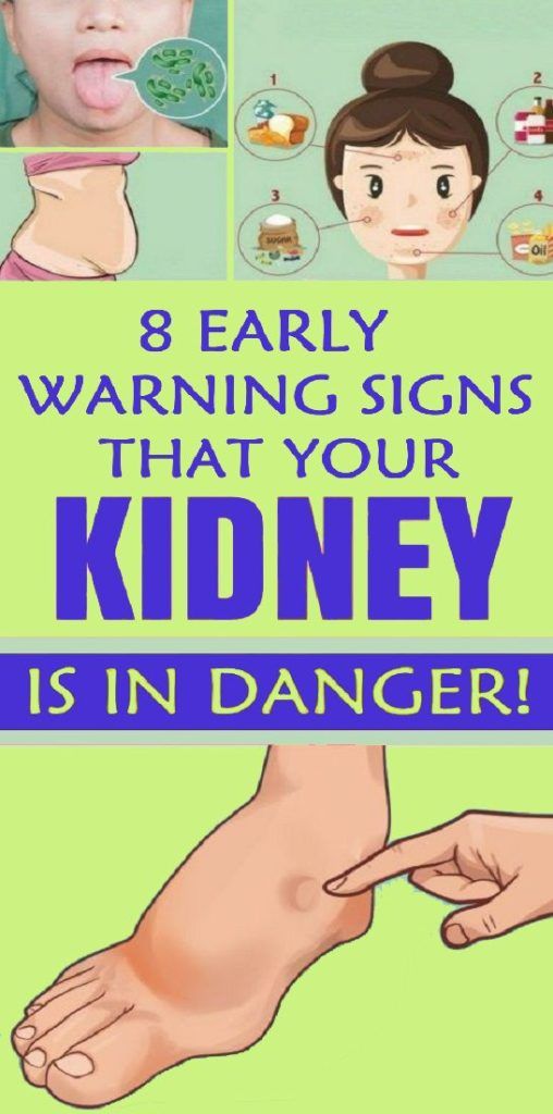 8 Warning Symptoms of Kidney Damage Wellness Care 101
