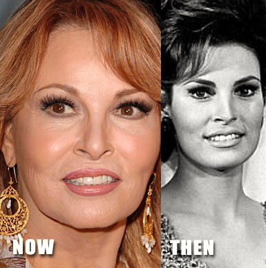 Raquel Welch Plastic Surgery Before After Photos