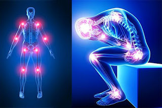 مرض فيبروميالجيا -الألم الليفى العضلى