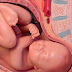 Bé vẫn ngôi ngược ở tuần 37, mẹ lo lắng và bác sỹ đã làm cách này để xoay ngôi cho bé thành công