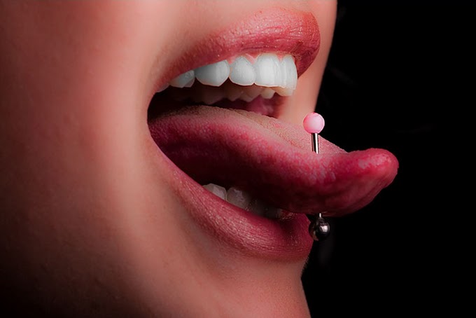 SALUD BUCAL: Crece el número de complicaciones derivadas del uso de piercings orales