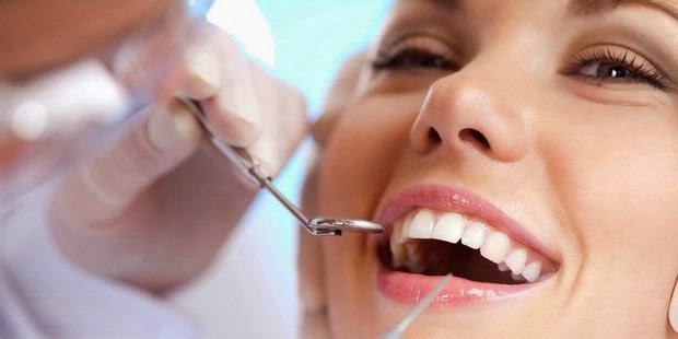 Cara Menghilangkan dan Membersihkan Karang Gigi