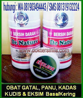 OBAT TRADISIONAL UNTUK MENGATASI GATAL AKIBAT JAMUR PALING MANJUR