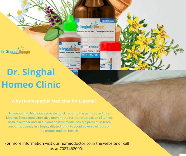 lipoma treatment homeopathy medicine