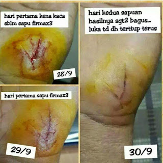 Kini telah hadir firmax3 rf3world krim penstabil hormon yang bekarja untuk menstabilkan hormon anda. Cream ajaib yang terbuat dari bahan herbal organik pilihan yang di ambil dari berbagai negara didunia. selain untuk pengobatan segala macam penyakit juga bisa untuk melangsingkan badan dan kecantikan. Cream dahsyat satu untuk semua. Bisa untuk mengencangkan kulit wajah, menghilangkahn flek, menghilangkan jerawat, menghilangkan kantung mata, menghilangkan goyor di dagu, menghilangkan goyor dilengan, mengobati luka bakar, menurunkan kolesterol, menurunkan asam urat, mengobati penyakit jantung, menormalkan kadar gula darah (diabet), menghilangkan keputihan, menghilangkan miom dan kista, merapatkan kembali miss v,  mengencangkan payudara, obat diabetes, obat stouke, obat asma, obat ambeien, obat sakit maag, obat keputihan, obat sinusitis, obat panu kadas kurap, obat eksim, obat jerawat, obat pelangsing, obat herves, obat penyubur, obat kanker, obat tumor, obat kencing manis