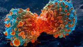 Cancer Cell