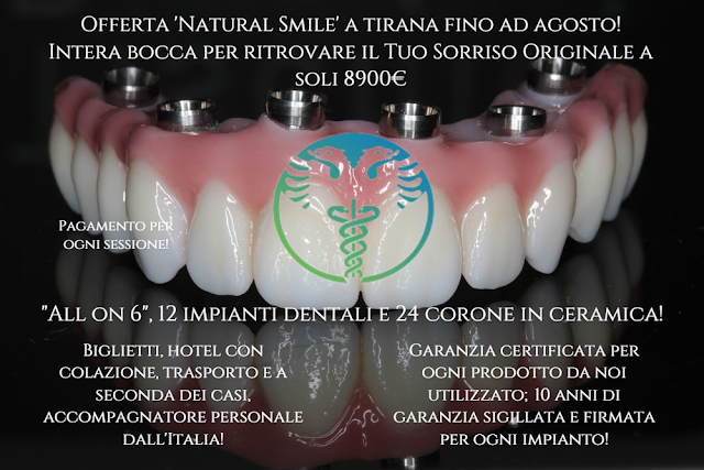 impianti dentali in albania con prezzi stupendi