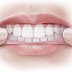  Các hình thức tẩy trắng răng phổ biến