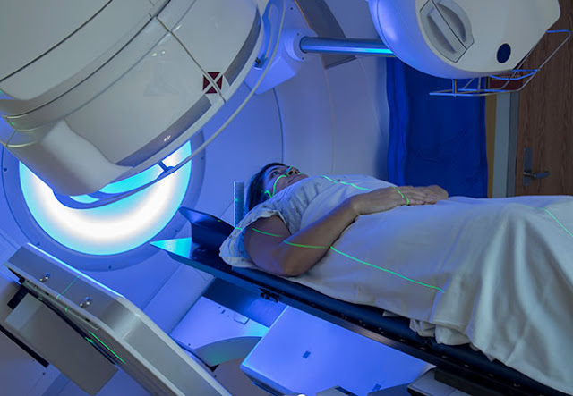 Global AI Radiation Dosing Market Size