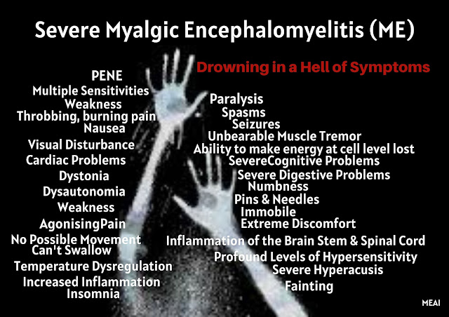 Severe Myalgic Encephalomyelitis (ME)
