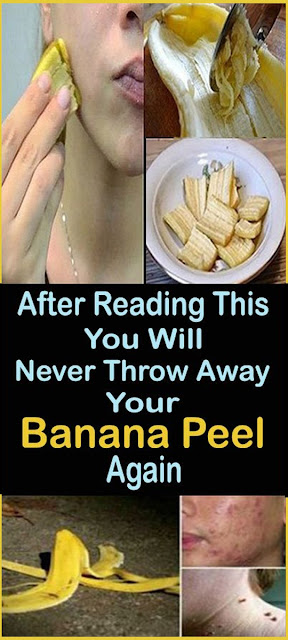 Once You Read This You Will Never Throw Away This Part Of The Banana